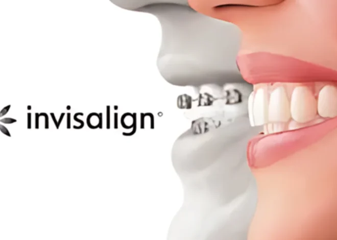 Invisalign Doctor Site Login and Troubleshoot: A Comprehensive Guide