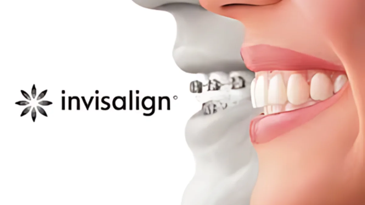 Invisalign Doctor Site Login and Troubleshoot: A Comprehensive Guide